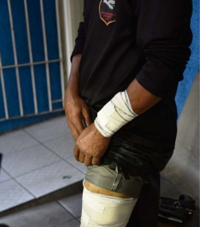 Segurança teve ferimentos no braço e na perna