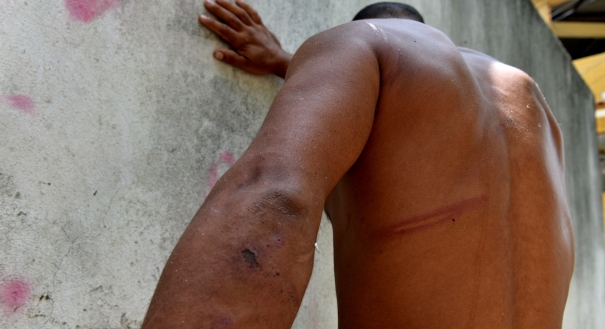 Ajudante de prático, 27, foi espancado enquanto esperava ônibus na Praia da Costa, em Vila Velha