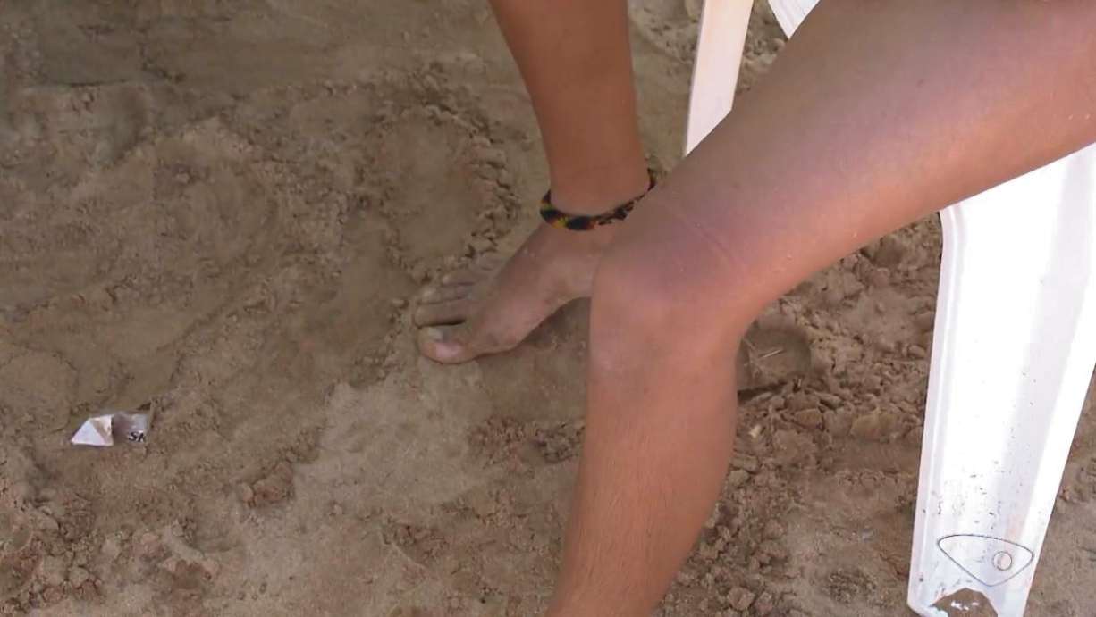 O menino recebeu atendimento na areia. Crédito: TV Gazeta