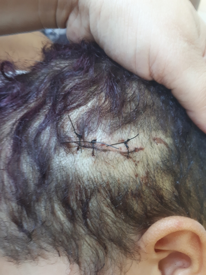 Criança é atacada por pitbull em Cariacica . Crédito: Iony Lopes