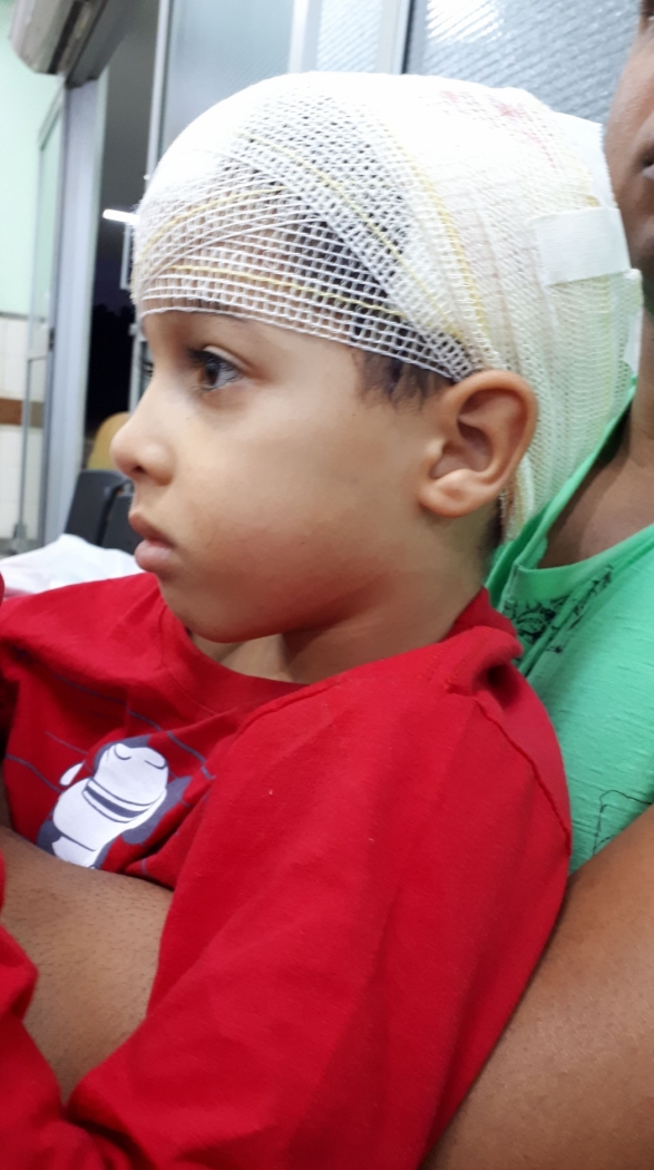 Criança foi atacada por pitbull em Cariacica . Crédito: Iony Lopes
