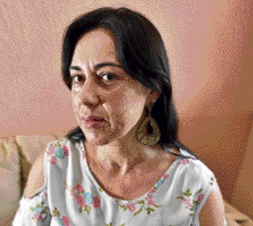 Aos 43 anos, Rosângela vem sofrendo com acne. Crédito: Marcelo Prest | GZ