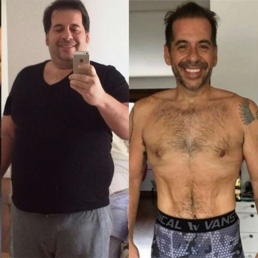 O antes e depois da cirurgia bariátrica de Hassum. Crédito: Divulgação